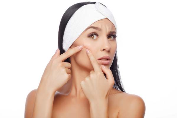 Causas da Acne adulta